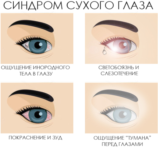 Лагофтальм это что в офтальмологии. Лечение