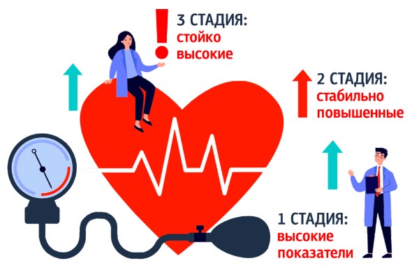 Лечение гипертонии 2 степени лекарственными препаратами. Схема