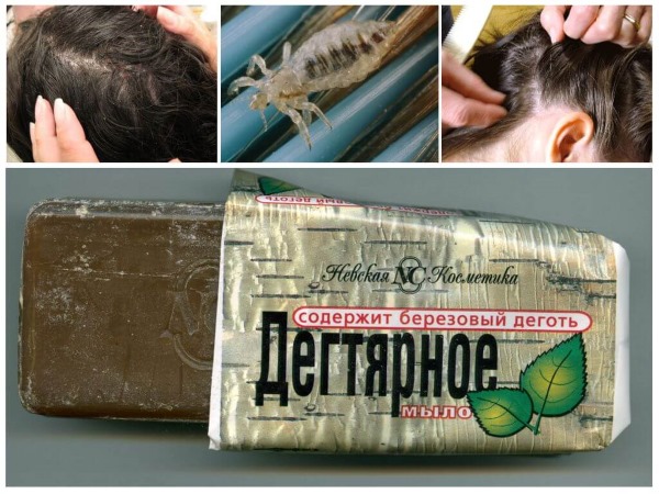 Лечение педикулеза у детей. Препараты, народные средства, лекарства