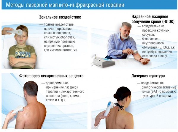 Магнитолазерная терапия. Что это за процедура, аппарат