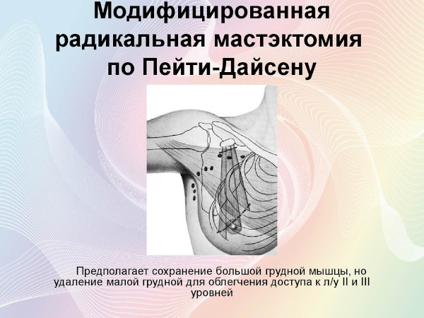 Мастэктомия (удаление молочной железы). Что это такое, фото, виды