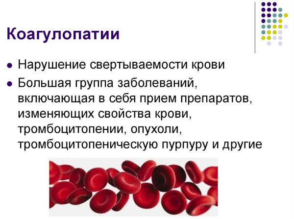 Мастэктомия (удаление молочной железы). Что это такое, фото, виды