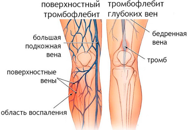 Механотерапия в реабилитации. Что это за процедура