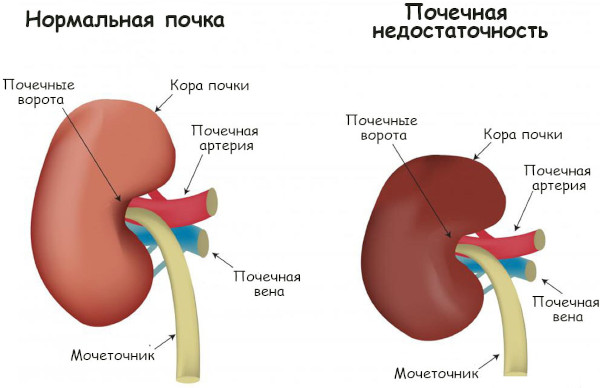 Мелбек (Melbek) уколы. Инструкция по применению, отзывы