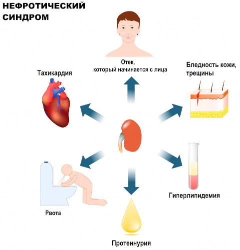 Мелбек (Melbek) уколы. Инструкция по применению, отзывы