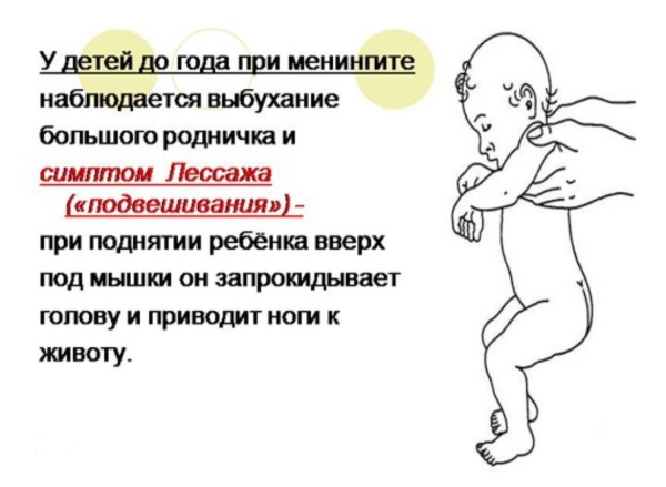 Менингит у детей 5-10 лет. Симптомы, как проявляется