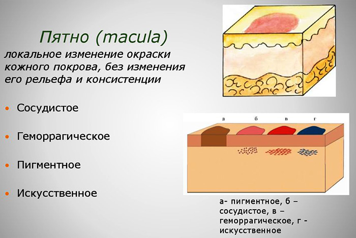 Морфологические элементы кожи первичные и вторичные. Таблица