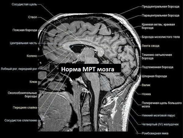 Боль в шее и затылке. Причины и лечение