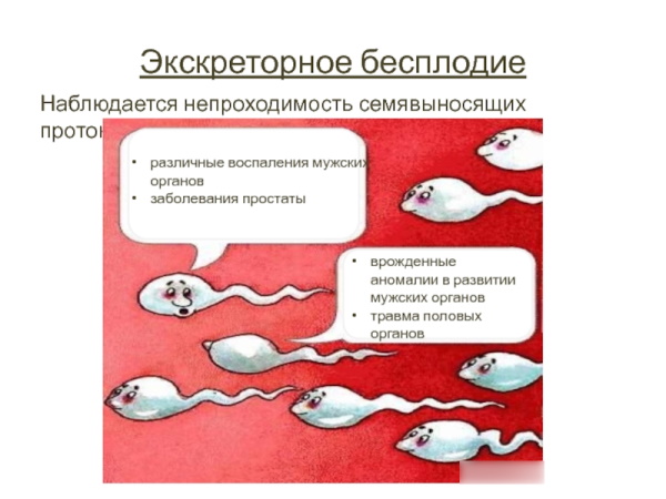 Мужское бесплодие. Лечится или нет, причины, симптомы