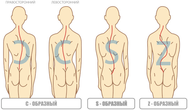 Мышцы-разгибатели спины. Функции, анатомия, упражнения, растяжка