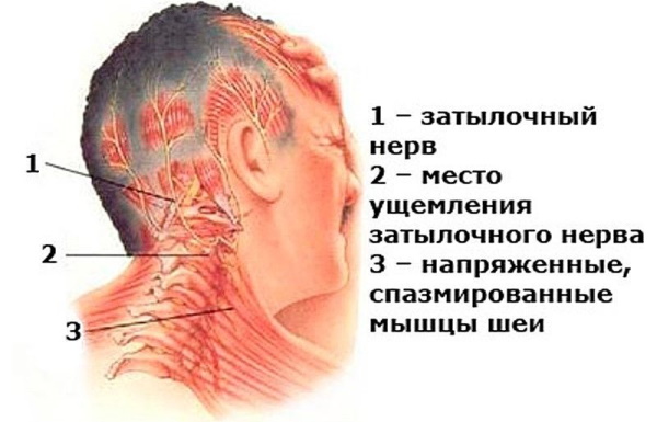 Нарушение статики шейного отдела позвоночника, поясничного, пояснично-крестцового, грудного