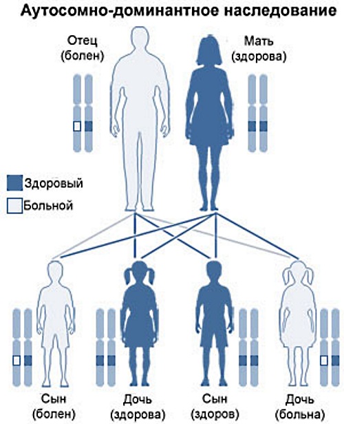 Наследственные болезни человека. Список с описанием, таблица