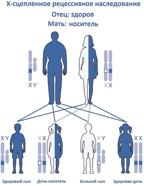 Наследственные болезни человека. Список с описанием, таблица