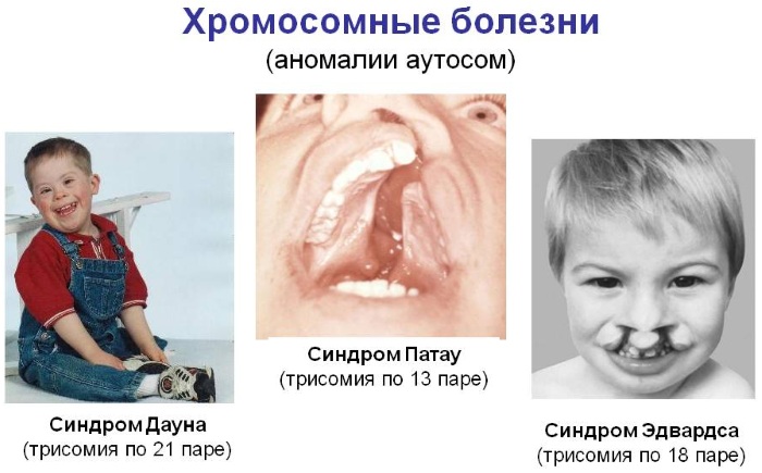 Наследственные болезни человека. Список с описанием, таблица