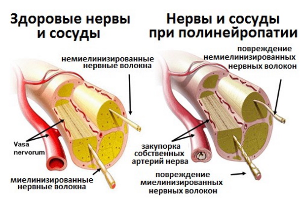 Октолипен (Octolipen) капельница. Инструкция, для чего, отзывы