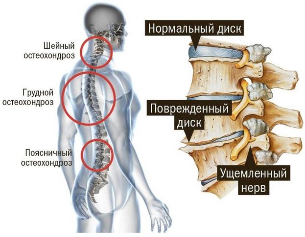 Боль между ребрами посередине спереди, при нажатии, если тяжело дышать