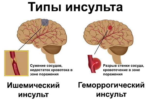 Нейрофизиолог. Кто это по специальности, что лечит врач