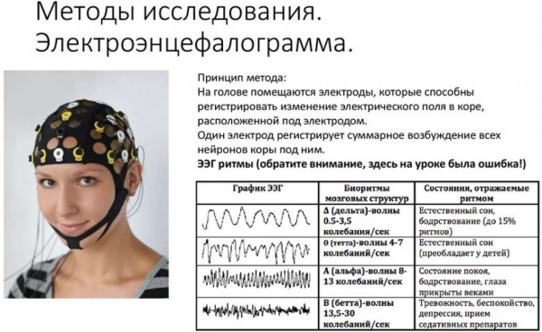 Нейрофизиолог. Кто это по специальности, что лечит врач