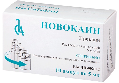 Блокада пояснично-крестцового отдела позвоночника при болях в пояснице