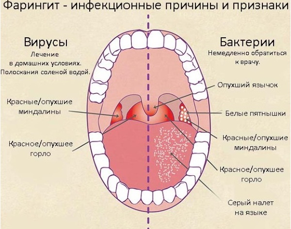 Болит шея спереди по бокам при надавливании. Причины