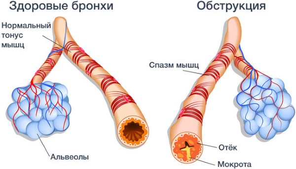 Бронхорасширяющие препараты. Таблетки для ингаляций взрослым