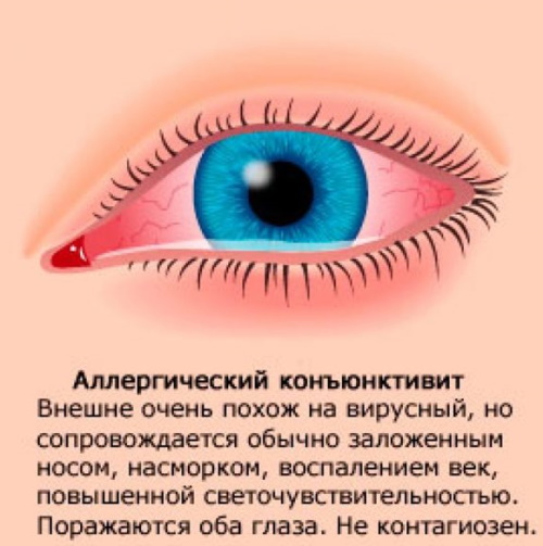 Зодак (Zodac) капли. Показания к применению