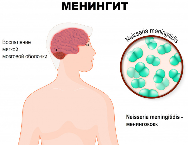 Опасность пневмонии. Осложнения, последствия болезни