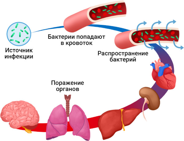 Опасность пневмонии. Осложнения, последствия болезни