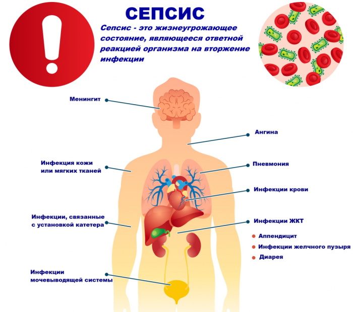 Отравление уксусом. Симптомы, первая помощь, рекомендации
