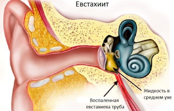 Евстахиева труба. Где находится, что соединяет, относится к какому уху, функции, болезни