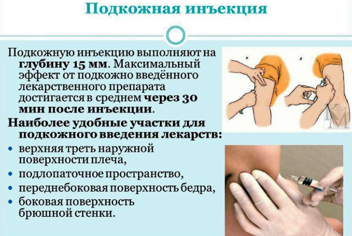 Парентеральный способ введения лекарственных средств в организм