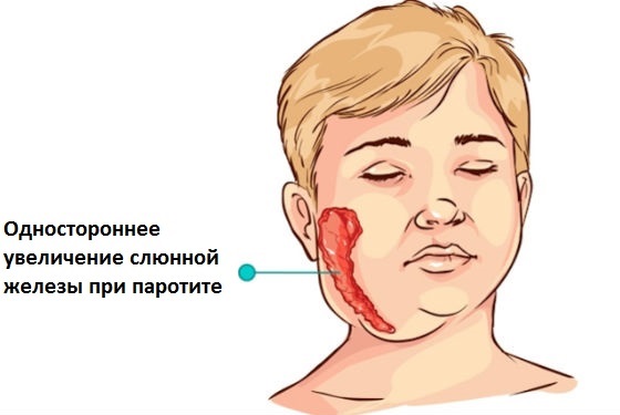 Азооспермия. Что это такое, лечится или нет