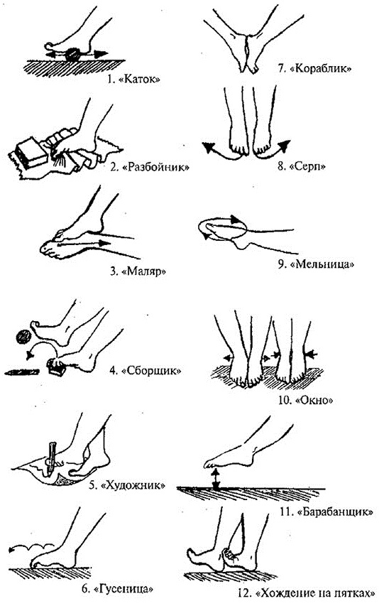 Плоскостопие. Симптомы у взрослых, степени, как определить, лечение
