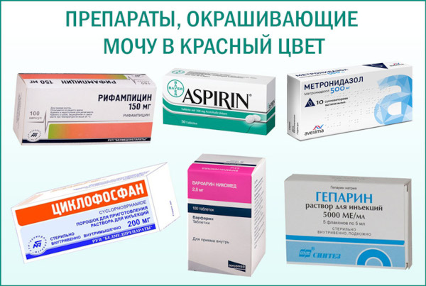 Почему моча желтая, ярко желтого лимонного цвета у женщин. Причины