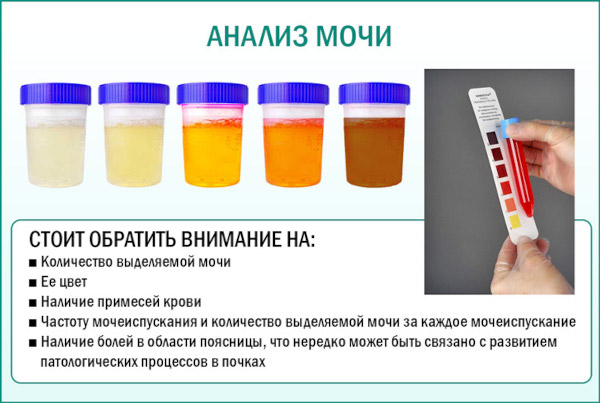 Почему моча желтая, ярко желтого лимонного цвета у женщин. Причины