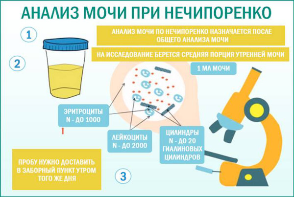 Почему моча желтая, ярко желтого лимонного цвета у женщин. Причины