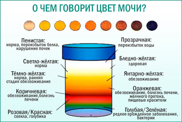 Цистит у детей. Симптомы и лечение в домашних условиях