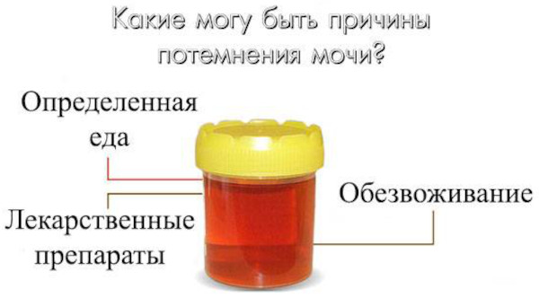 Почему моча желтая, ярко желтого лимонного цвета у женщин. Причины