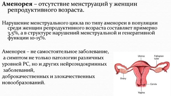 Почему не идут месячные. Причины, кроме беременности, что делать