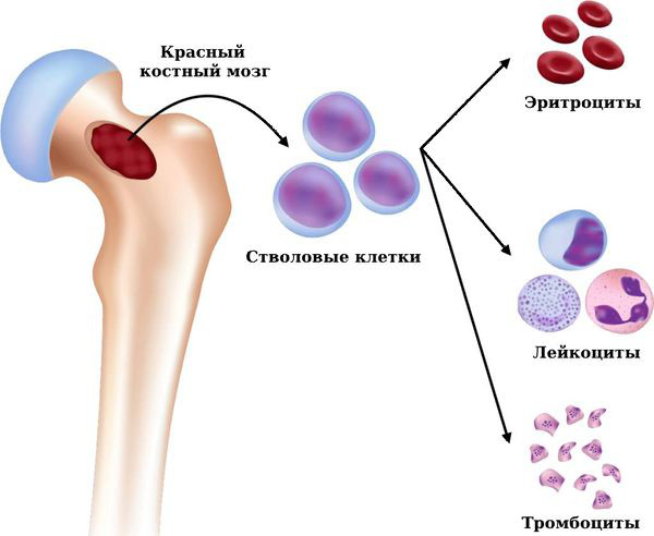 Полицитемия истинная (эритремия, болезнь Вакеза). Что это такое
