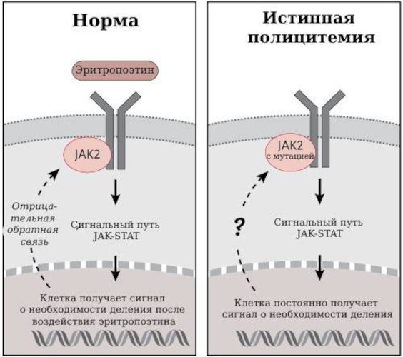 Полицитемия истинная (эритремия, болезнь Вакеза). Что это такое