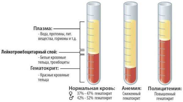 Полицитемия истинная (эритремия, болезнь Вакеза). Что это такое
