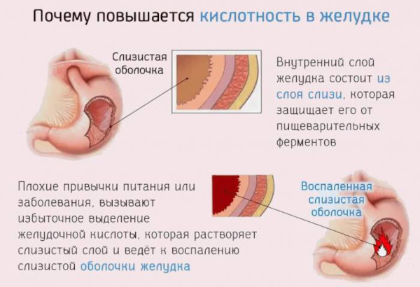 Фламин (Flamin) таблетки. Инструкция по применению, цена