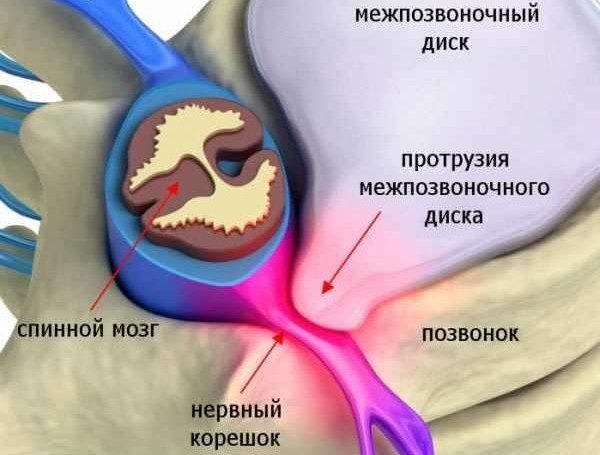 Причины болевых ощущений на шее сзади. Возможные заболевания и проблемы со здоровьем