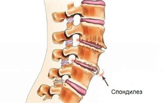 Причины болевых ощущений на шее сзади. Возможные заболевания и проблемы со здоровьем