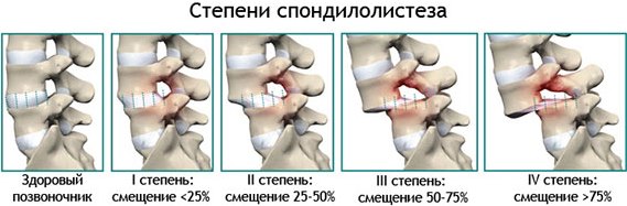 Причины болевых ощущений на шее сзади. Возможные заболевания и проблемы со здоровьем