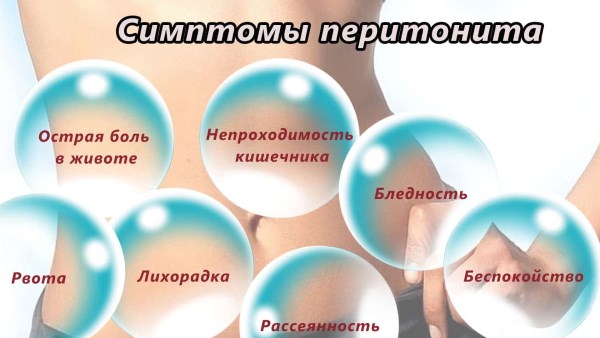 Причины и лечение кишечника при вздутии живота после еды. Симптомы заболеваний органов ЖКТ