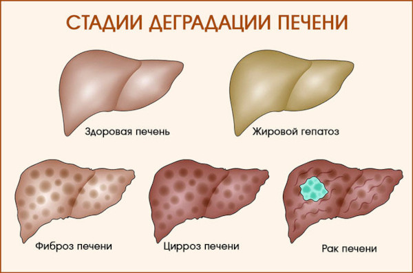 Прививка от гепатита А взрослым. Побочные эффекты
