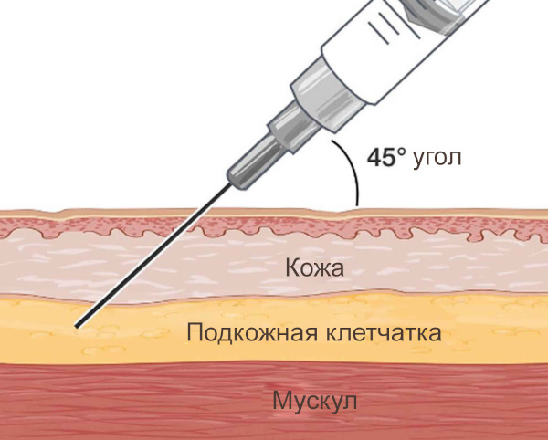 Прививки детям. График до 1 года по месяцам, таблица