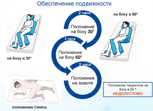 Профилактика пролежней. Что это такое, как выглядят, фото, виды